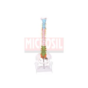 Pathological Spine Model